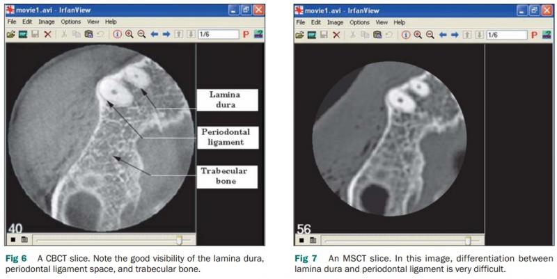 cbct scan compared to ct scan